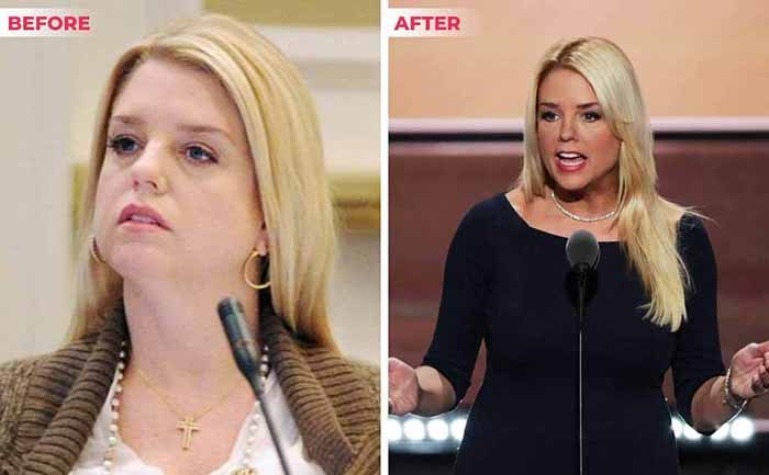 Pam Bondi weight loss Before after