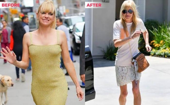 Anna Faris weight loss before after
