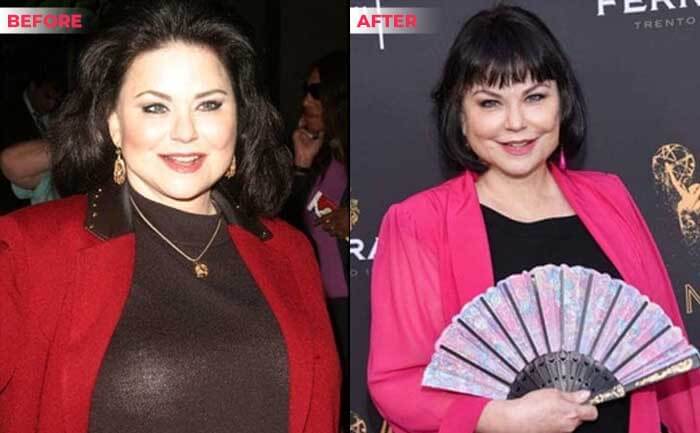 Delta Burke weight loss before after