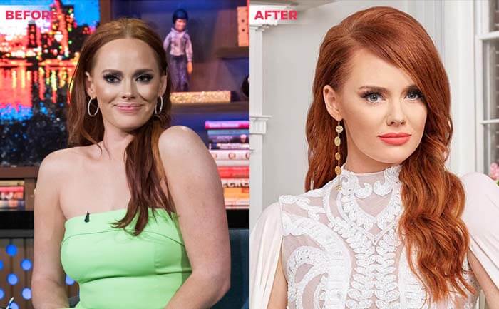 Kathryn Dennis weight loss before after