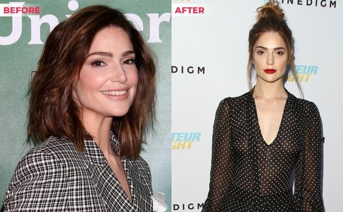 Did Janet Montgomery Have Plastic Surgery Everything