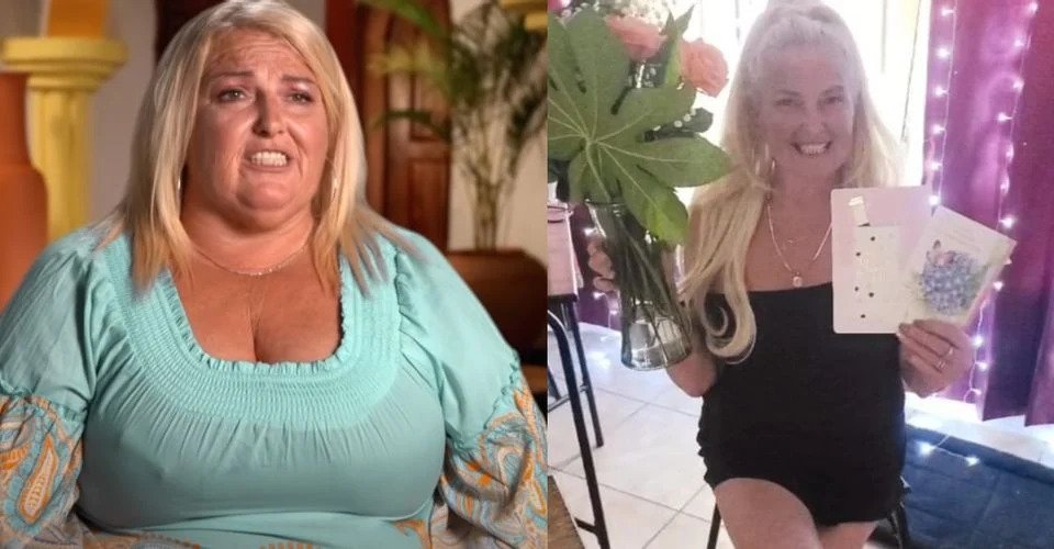 Angela Deem before and after weight loss surgery