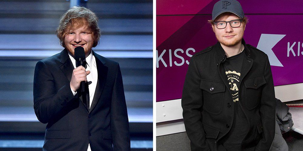 Ed Sheeran before and after weight loss