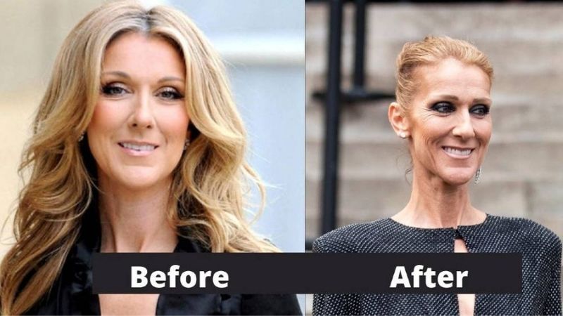 celine dion before weight loss